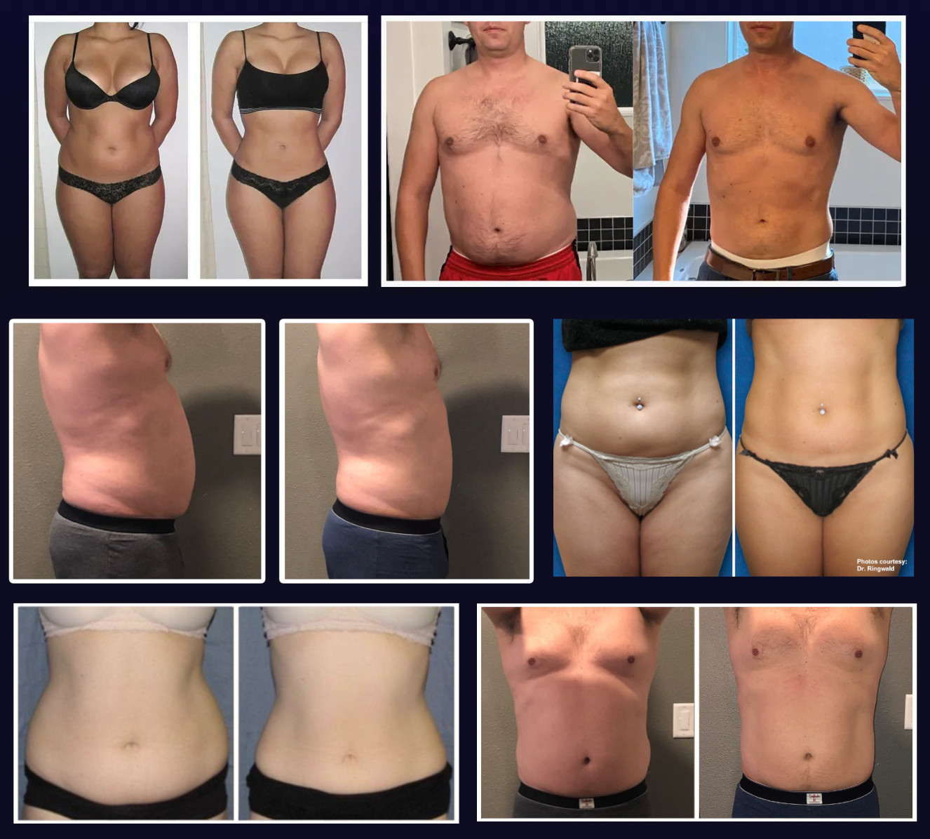 Before and after collage placeholder